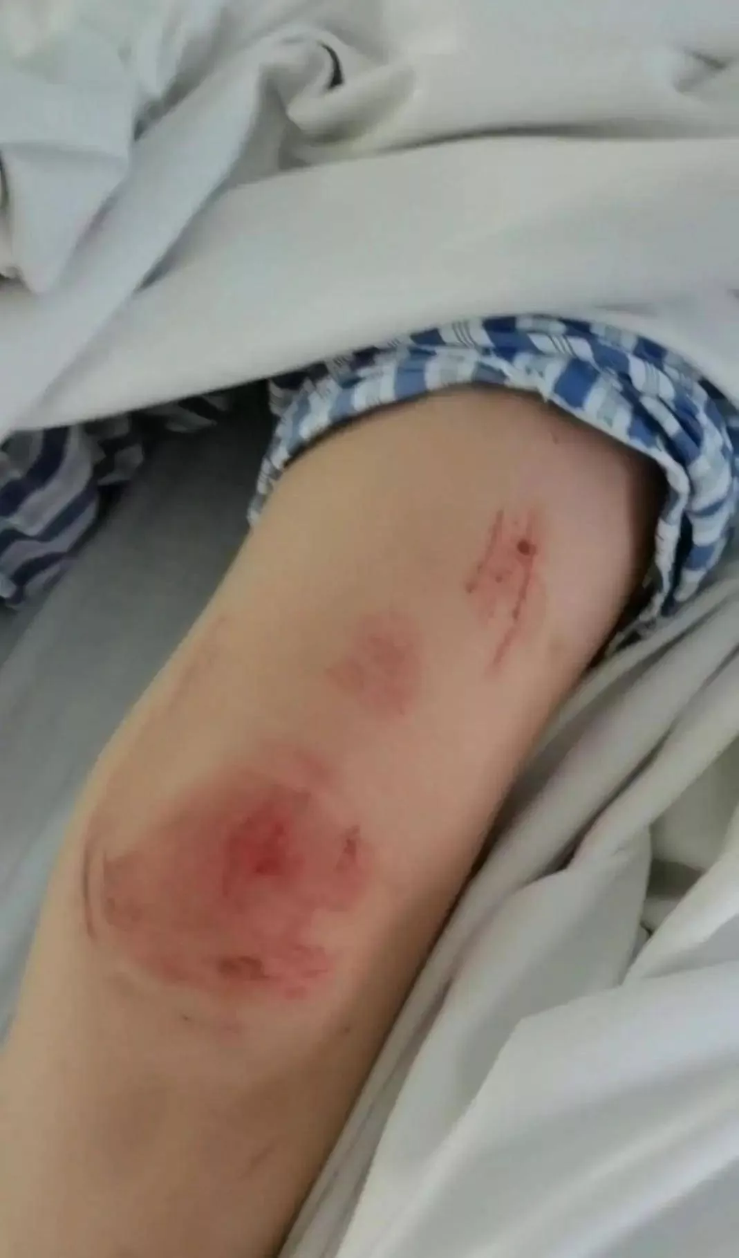 河北女子遭家暴驾车逃跑致丈夫身亡案二审维持原判